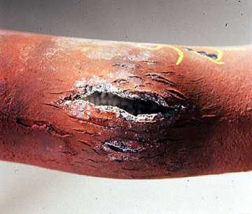 Figure 16-1. Overheating of this superheater tube was caused by deposits that resulted from boiler carryover into the steam.