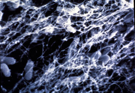 Figure 26-2. Extracellular polymers (visible in this scanning electron photomicrograph as a dehydrated fibrous network) may protect attached microorganisms.