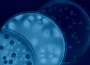 可用于生物负载测试和快速微生物学方法的培养皿照片