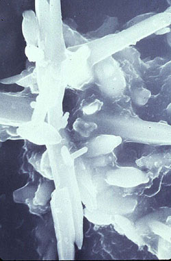 Figure 12-8. (Left) Scanning electron photomicrograph (4000X magnification) of calcium phosphate-magnesium silicate crystals formed in boiler water not treated with dispersant. (Right) With a sulfonated polymer, crystal growth is controlled.