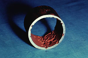 Figure 14-1. Economizer tube severely damaged by oxygen.